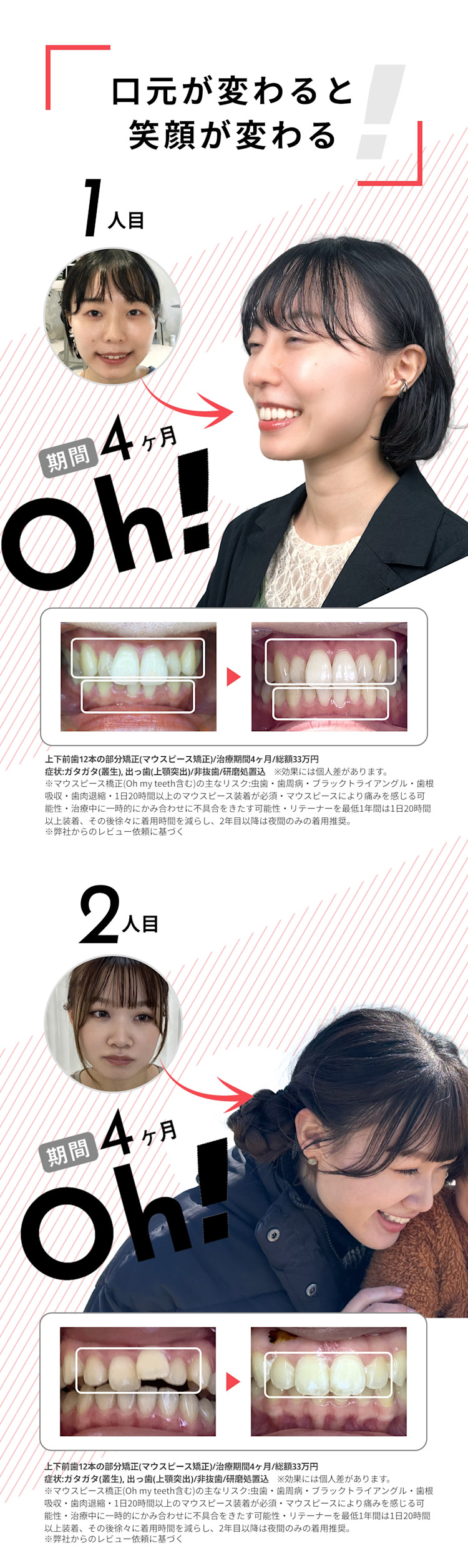 口元が変わると笑顔が変わる