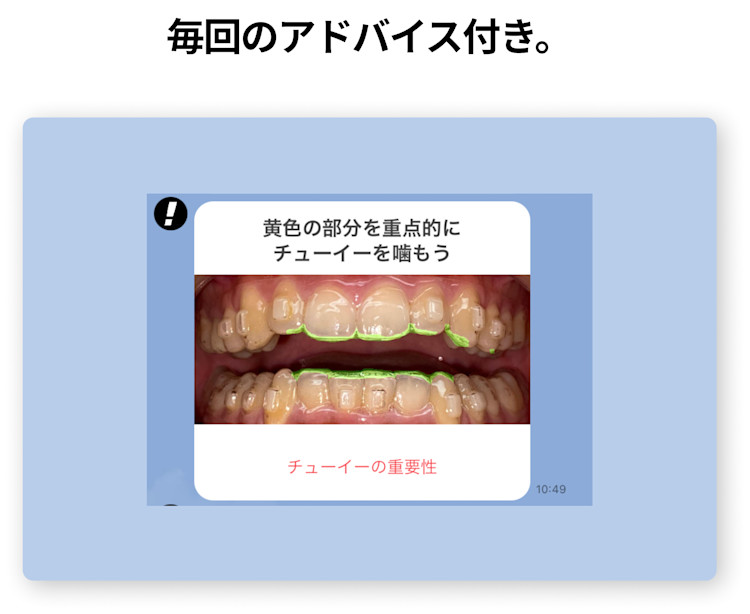 アドバイス付き