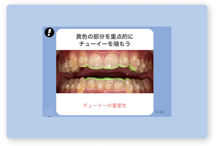アドバイス付き